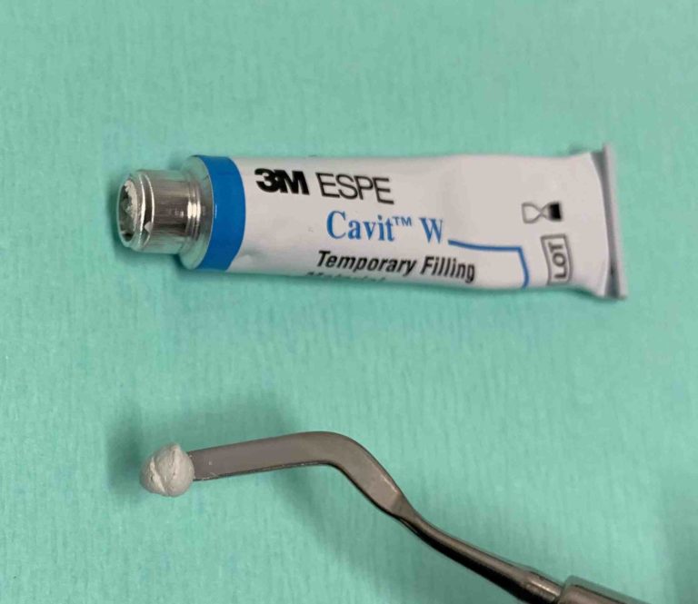 Cavit™ W Odontoulouse